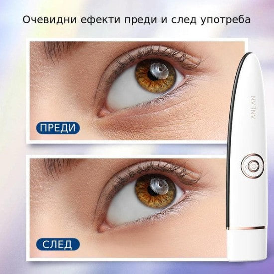 Очевидни ефекти преди и след употреба на уреда за подмладяване на кожата около очите.