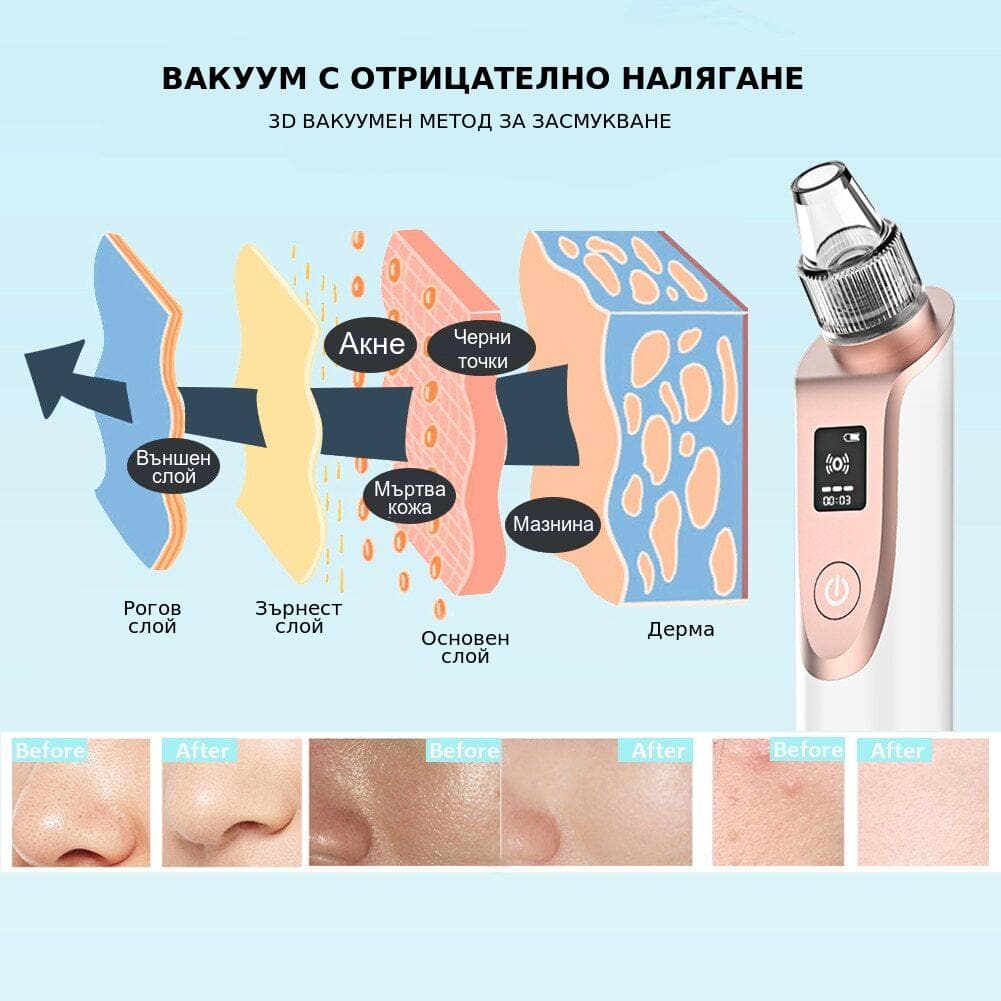 Нова вакуумна помпа за премахване на черни точки от лицето.