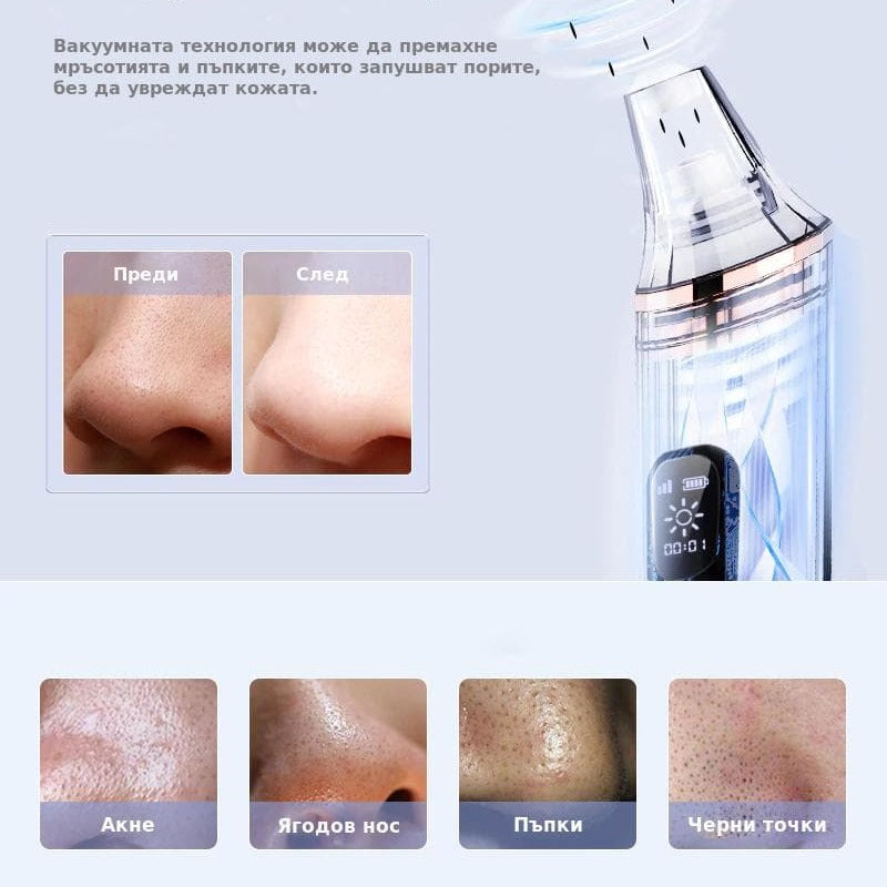 Технология за силно вакуумно засмукване премахва черните точки, акнето, пъпките и точките по ягодовия нос.